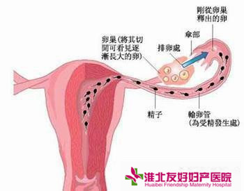 输卵管不孕有哪些常见症状